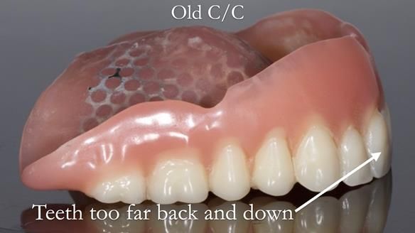 Newsletter 50 Special edition Complete Dentures FULL PROTOCOL