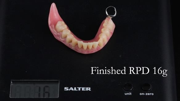 Finlay's Newsletter 59 Ultra hard partial dentures made for Gill