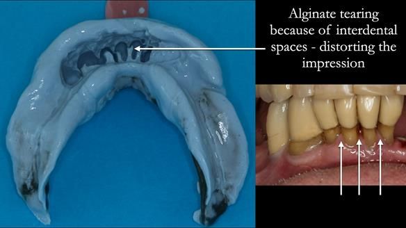 Ken – going downhill, first class