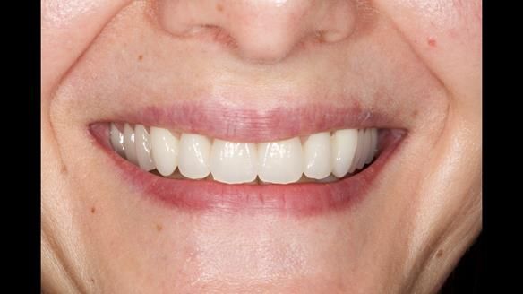 Newsletter 79 – Creating a wonderful smile and changing a life.