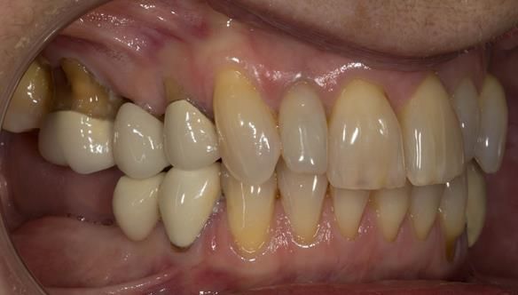 Figure 4 Pre - treatment.