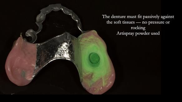 Ken – going downhill, first class