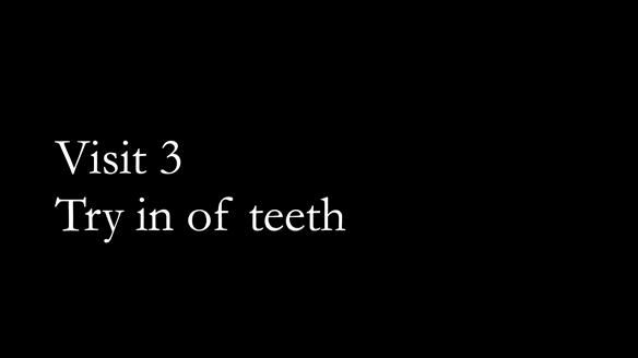 Newsletter 51 Managing Anne’s failing dentition with distal extension base RPD/Splint FULL PROTOCOL