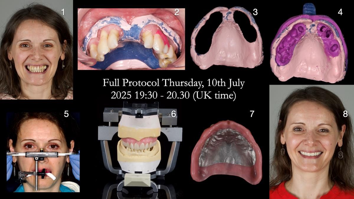 Newsletter 79 – Creating a wonderful smile and changing a life.