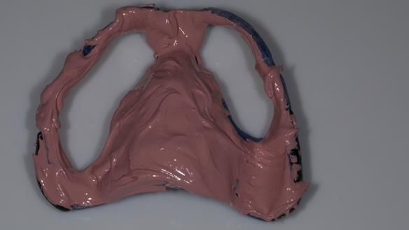 Newsletter 79 – Creating a wonderful smile and changing a life.