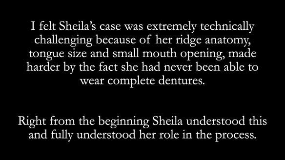 Newsletter 83: Sheila’s Complete Denture Success