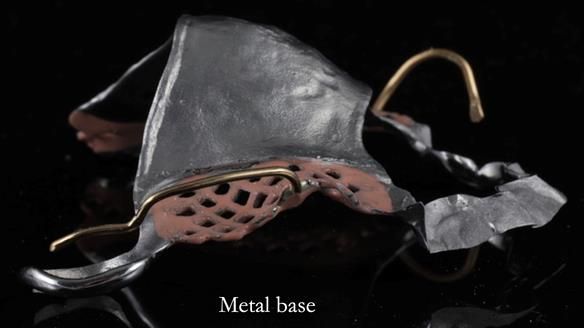 Finlay's Newsletter 60 Sylvia's upper Kennedy Class 2 Mod 1 metal based upper RPD