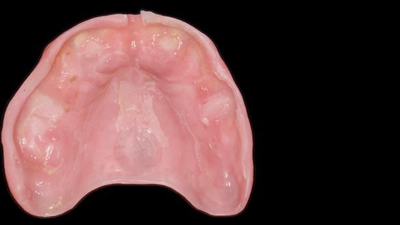 Newsletter 79 – Creating a wonderful smile and changing a life.