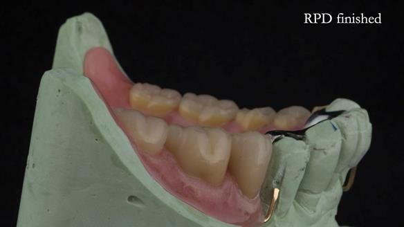 Ken – going downhill, first class