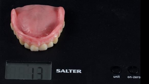 Newsletter 83: Sheila’s Complete Denture Success