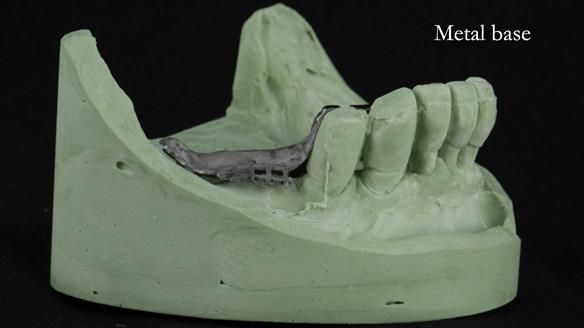 Ken – going downhill, first class