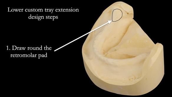 Newsletter 50 Special edition Complete Dentures FULL PROTOCOL