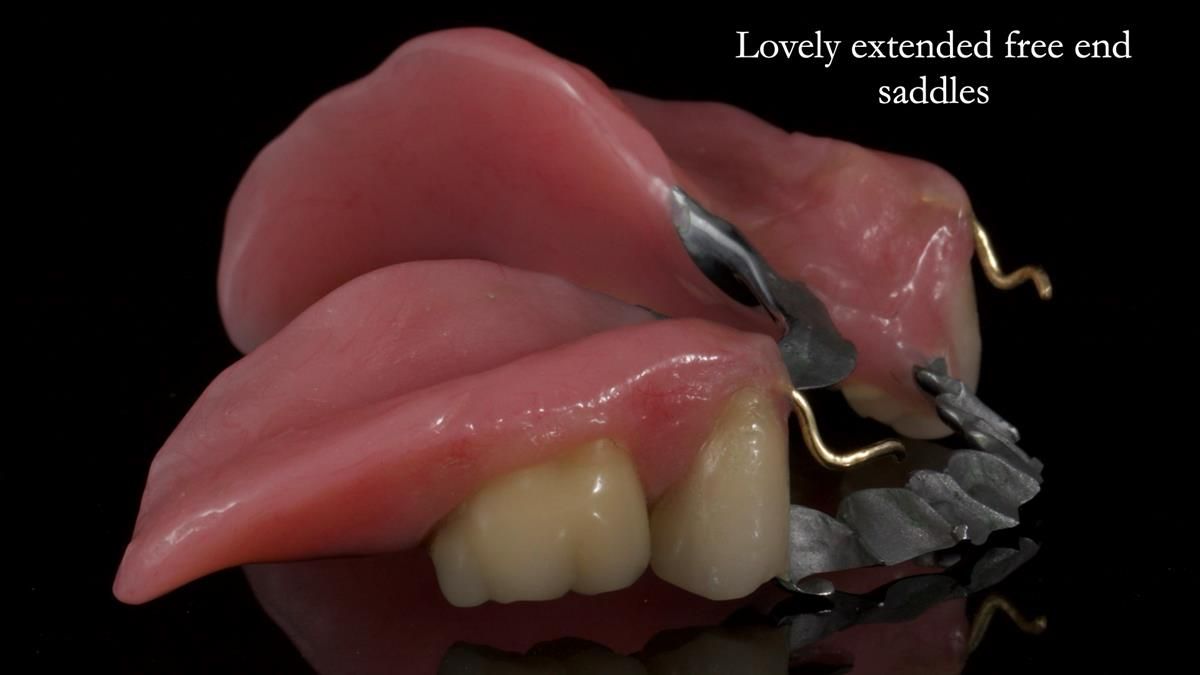 Newsletter 87 – Father Peter: A Partial Denture that needed Minor Miracle