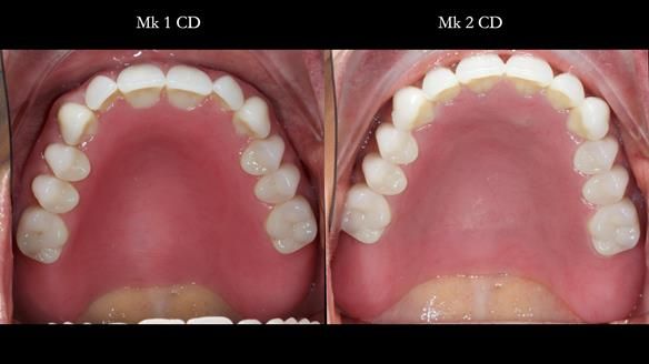 Newsletter 79 – Creating a wonderful smile and changing a life.