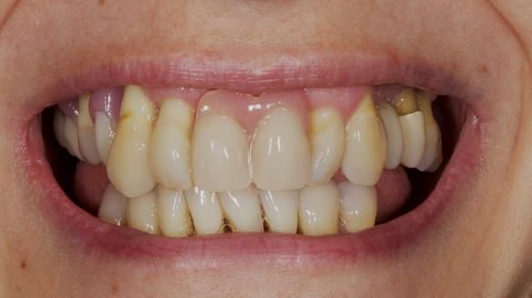 Newsletter 79 – Creating a wonderful smile and changing a life.