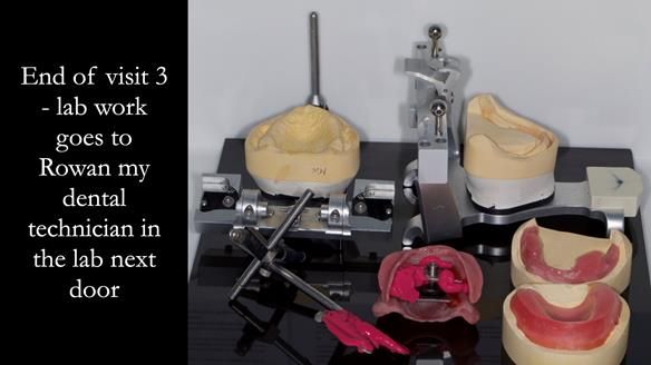 Newsletter 50 Special edition Complete Dentures FULL PROTOCOL