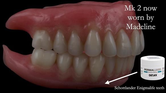 Replacing Madeline’s Complete denture FULL PROTOCOL