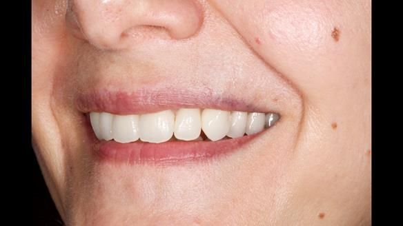 Newsletter 79 – Creating a wonderful smile and changing a life.