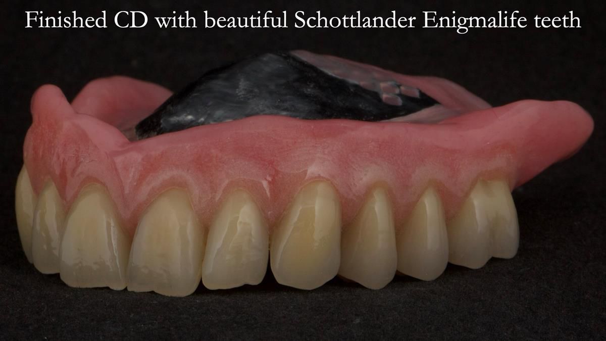 Newsletter 87 – Father Peter: A Partial Denture that needed Minor Miracle