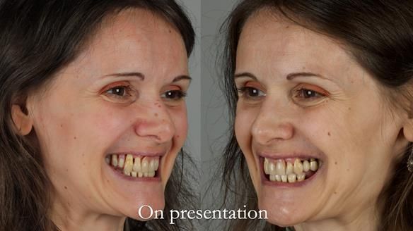 Newsletter 79 – Creating a wonderful smile and changing a life.