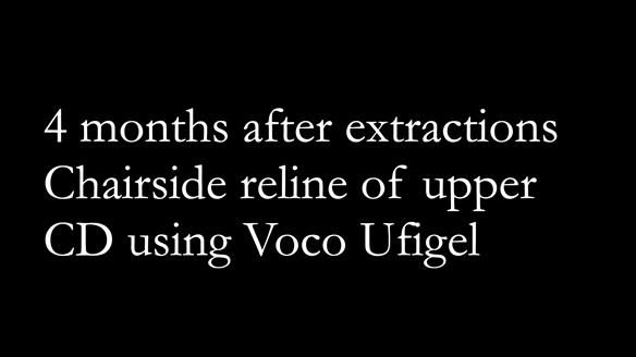 Finlay's Newsletter 62 provision of extractions and metal based complete dentures for Rafique