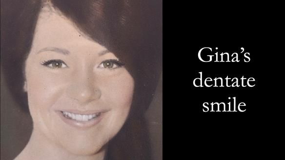 Finlay's Case Study Newsletter 40 - Immediate Mk 1 RPD to Definitive Mk 2 RPD - full protocol