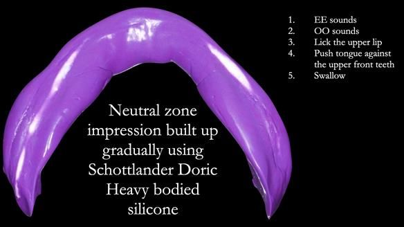 Replacing Madeline’s Complete denture FULL PROTOCOL