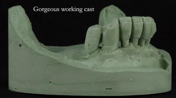 Ken – going downhill, first class