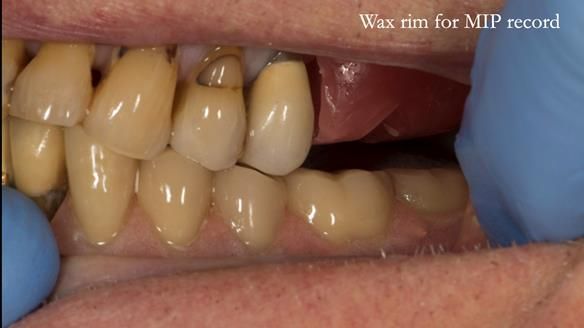 Ken – going downhill, first class