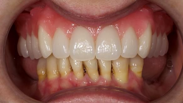 Newsletter 79 – Creating a wonderful smile and changing a life.