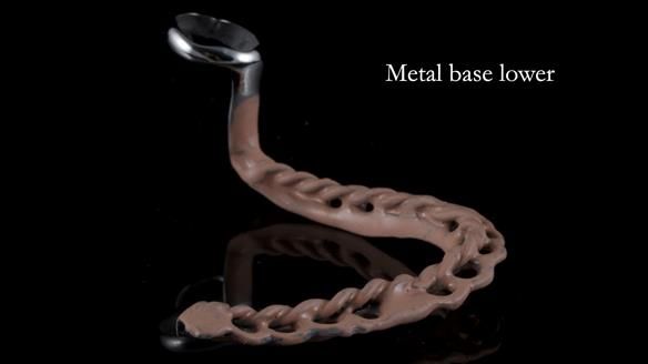 Finlay's Newsletter 59 Ultra hard partial dentures made for Gill