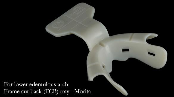 A “frame cut back tray” is loaded with heavy bodied alginate