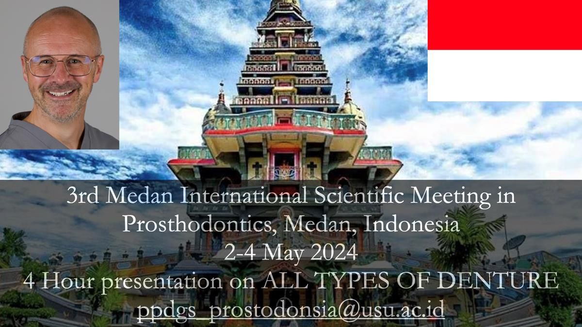 Finlay's Newsletter 60 Sylvia's upper Kennedy Class 2 Mod 1 metal based upper RPD