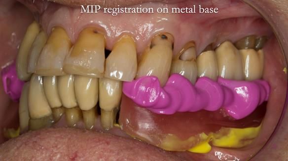 Ken – going downhill, first class