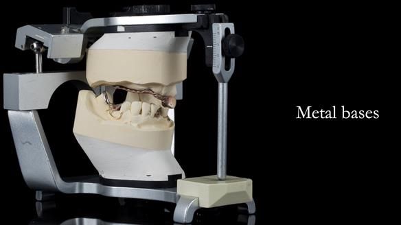 Newsletter 55 Provision of metal based partial dentures for Zephyrine with a repaired cleft lip and palate