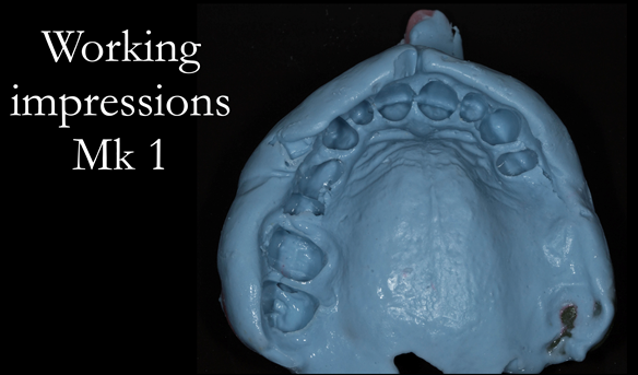 Figure 18 Working impression for Mk 1 denture.