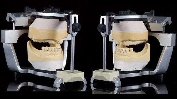 Newsletter 79 – Creating a wonderful smile and changing a life.