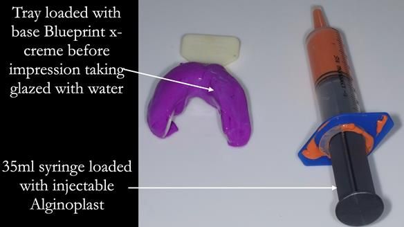 Replacing Madeline’s Complete denture FULL PROTOCOL