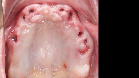 Newsletter 79 – Creating a wonderful smile and changing a life.