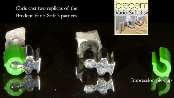 Newsletter 76: Jackie’s case – Telescopic overdenture & precision RPD (the tricky truth!)