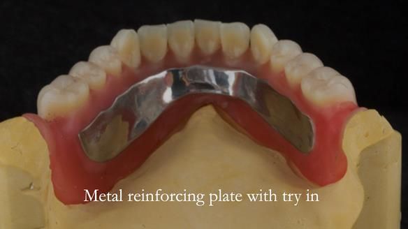 Wax try in ready for visit 4