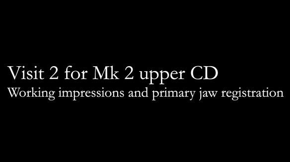 Newsletter 79 – Creating a wonderful smile and changing a life.