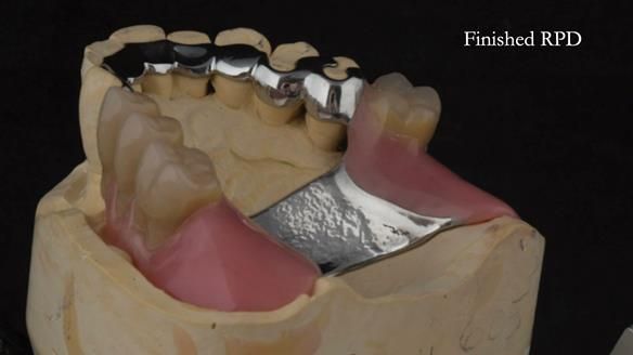 Ken – going downhill, first class