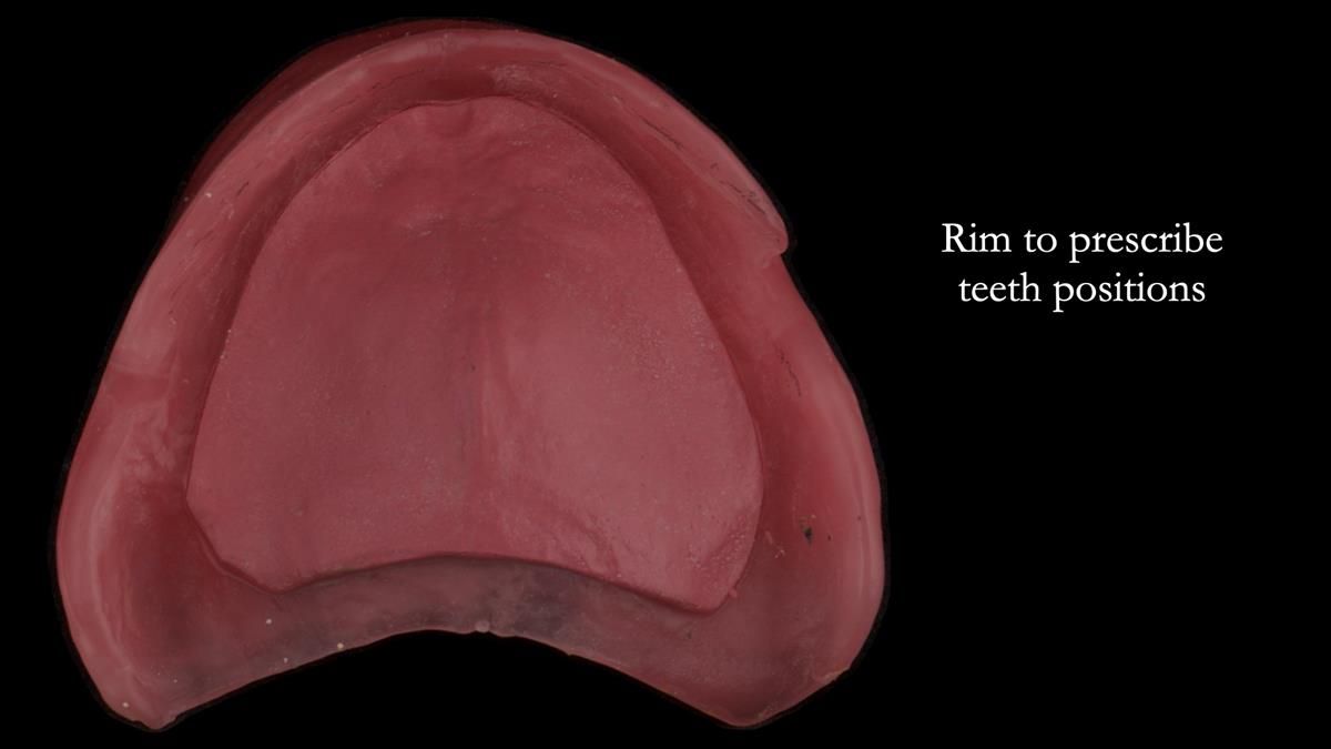Newsletter 87 – Father Peter: A Partial Denture that needed Minor Miracle