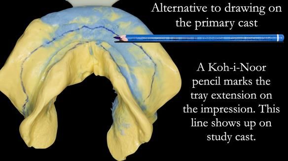 Newsletter 50 Special edition Complete Dentures FULL PROTOCOL