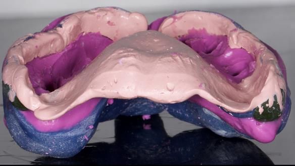 Newsletter 79 – Creating a wonderful smile and changing a life.