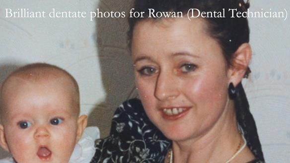 Solving Linda’s Failed “All on 4” implant bridges - full protocol Newsletter 42