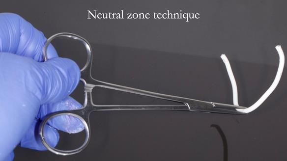 Newsletter 83: Sheila’s Complete Denture Success