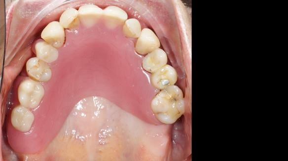 Newsletter 79 – Creating a wonderful smile and changing a life.