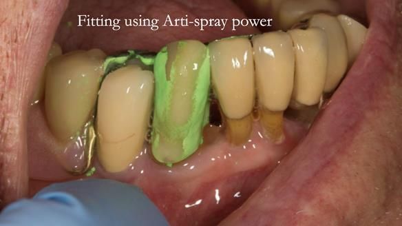 Ken – going downhill, first class